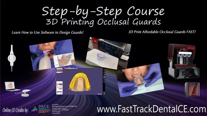 Step-by-Step Digital Occlusal Guards