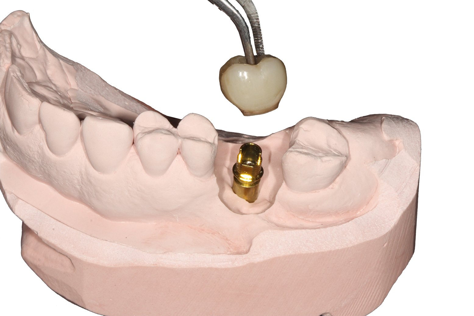 Cementing a crown to a dental model