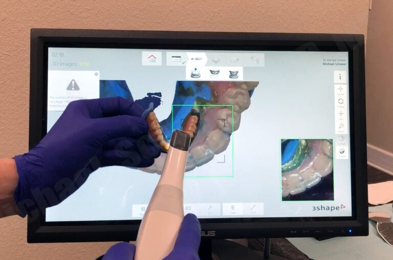 The “Reference Denture Technique” – Key for Simplifying Digital Denture Workflows