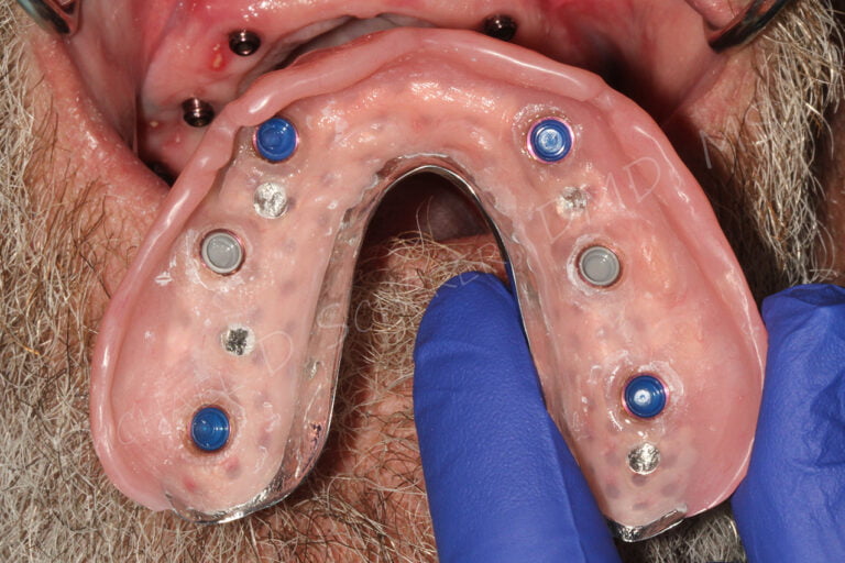 Followup Appointments and Checking Inserts for LOCATOR