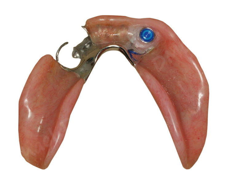 Root Resurgence LOCATOR Root is Back!